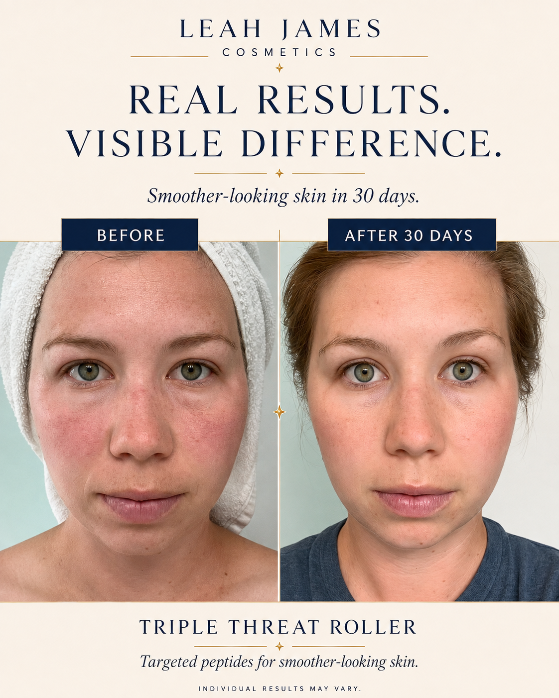 Before and after results with Triple Threat Peptide Serum Roller