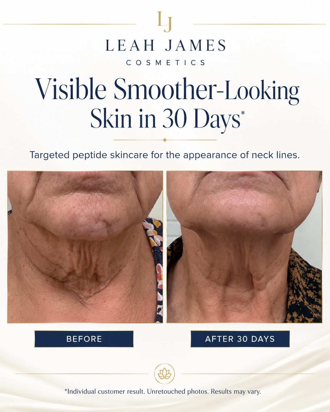 Before and after results with Triple Threat Peptide Serum Roller